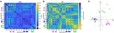 Robust Assessment of EEG Connectivity Patterns in Mild Cognitive Impairment and Alzheimer's Disease